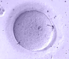 Immature oocyte at the stage of metaphase I